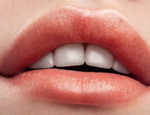 Need-to-know Details for Lip Filler